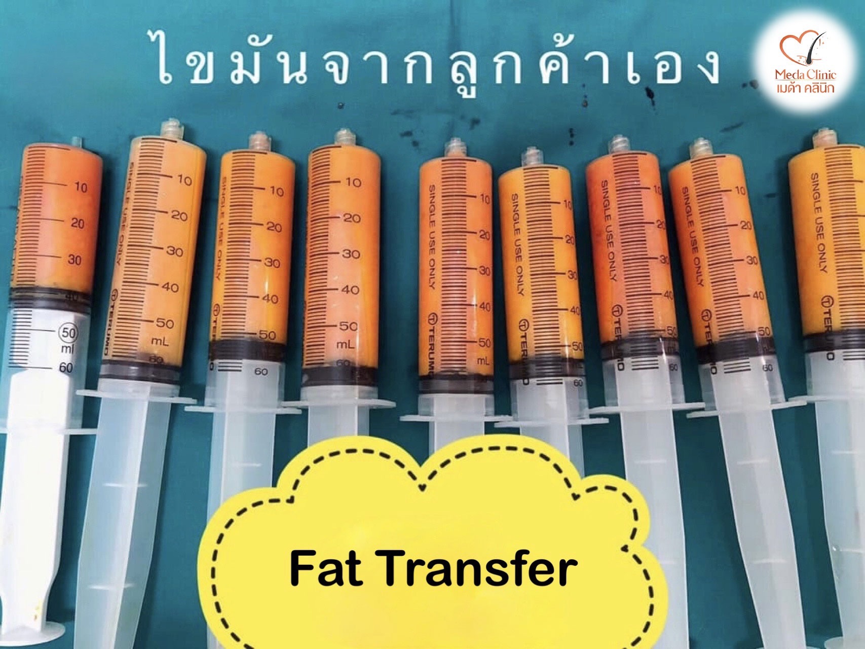 Fat Transfer Chiangmai