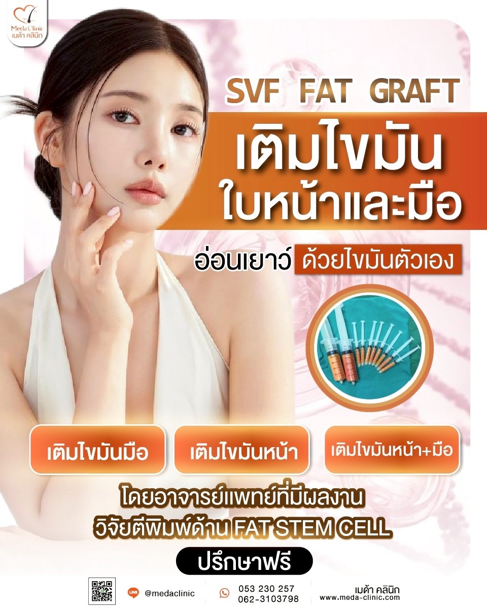Fat Transfer Chiangmai