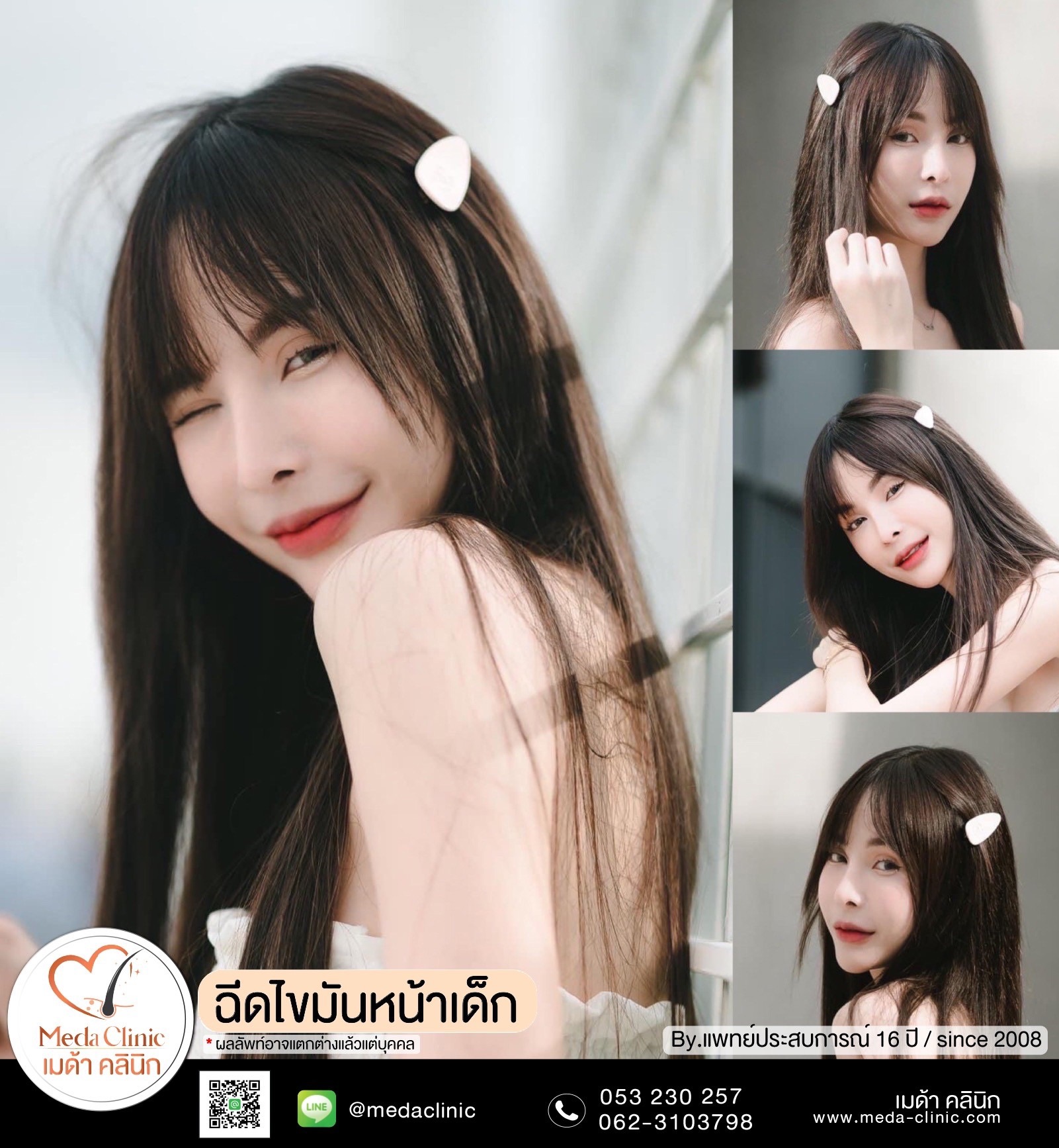 ฉีด fat หน้า เชียงใหม่