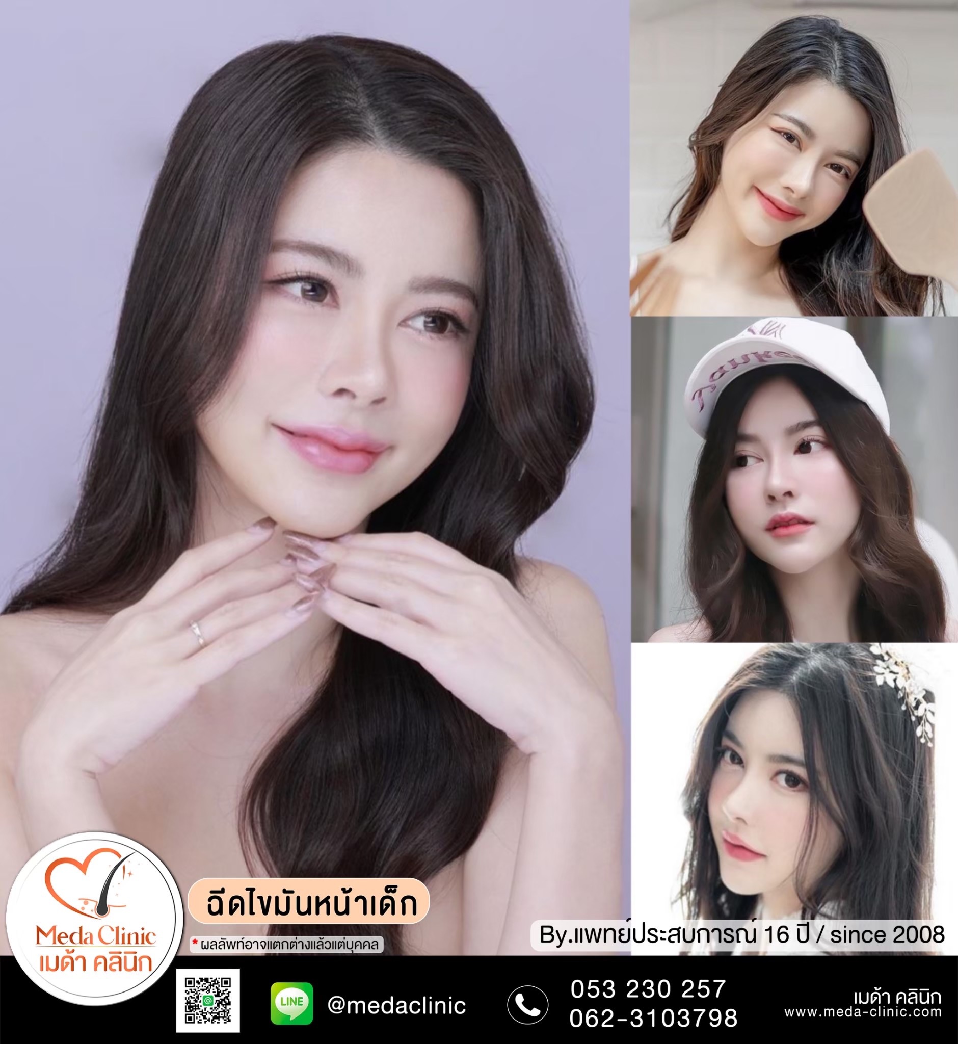 ฉีด fat หน้า เชียงใหม่