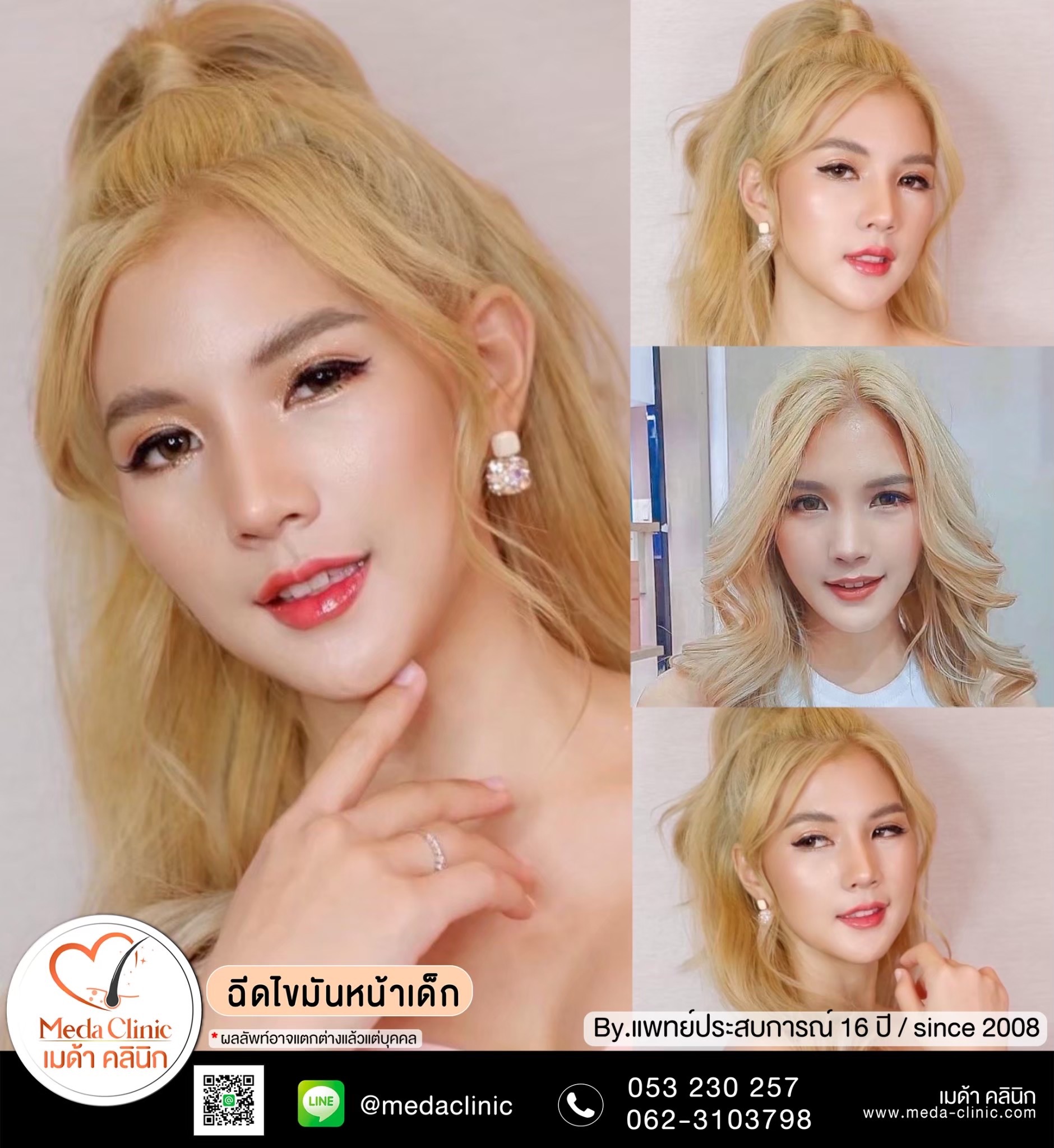 ฉีด fat หน้า เชียงใหม่