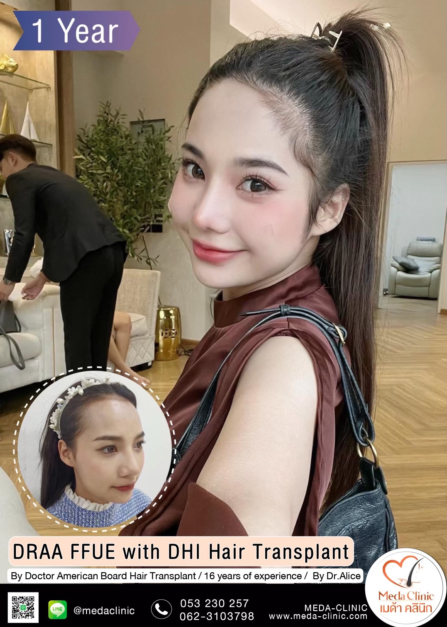 ABHRS hair transplant Thailand