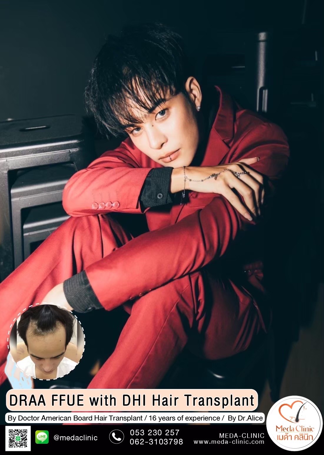 ABHRS hair transplant Thailand