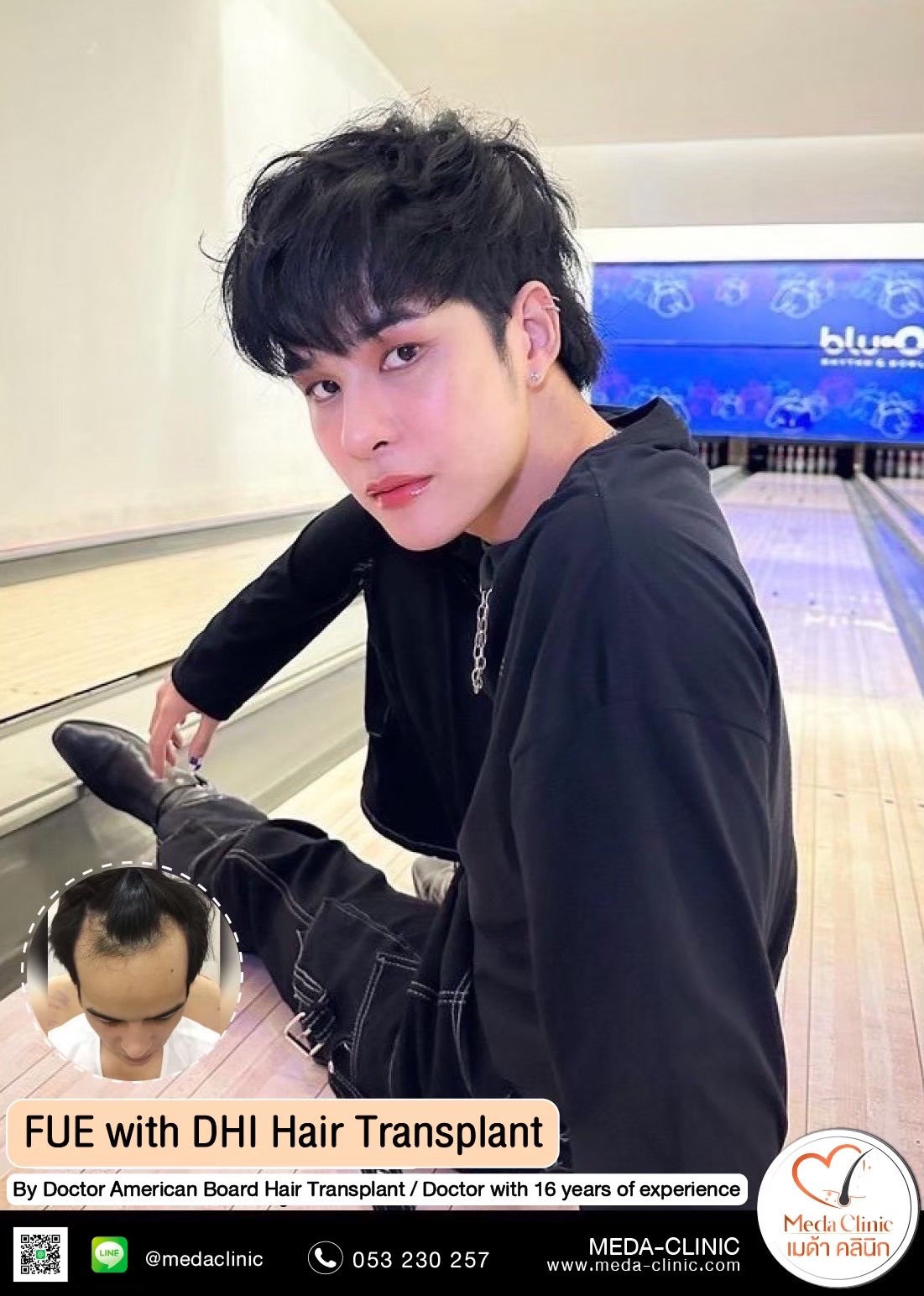 ABHRS hair transplant Thailand