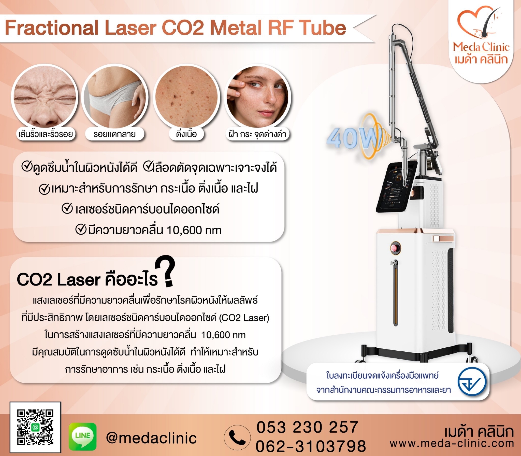 เลเซอร์ฝ้ากระที่ไหนดี