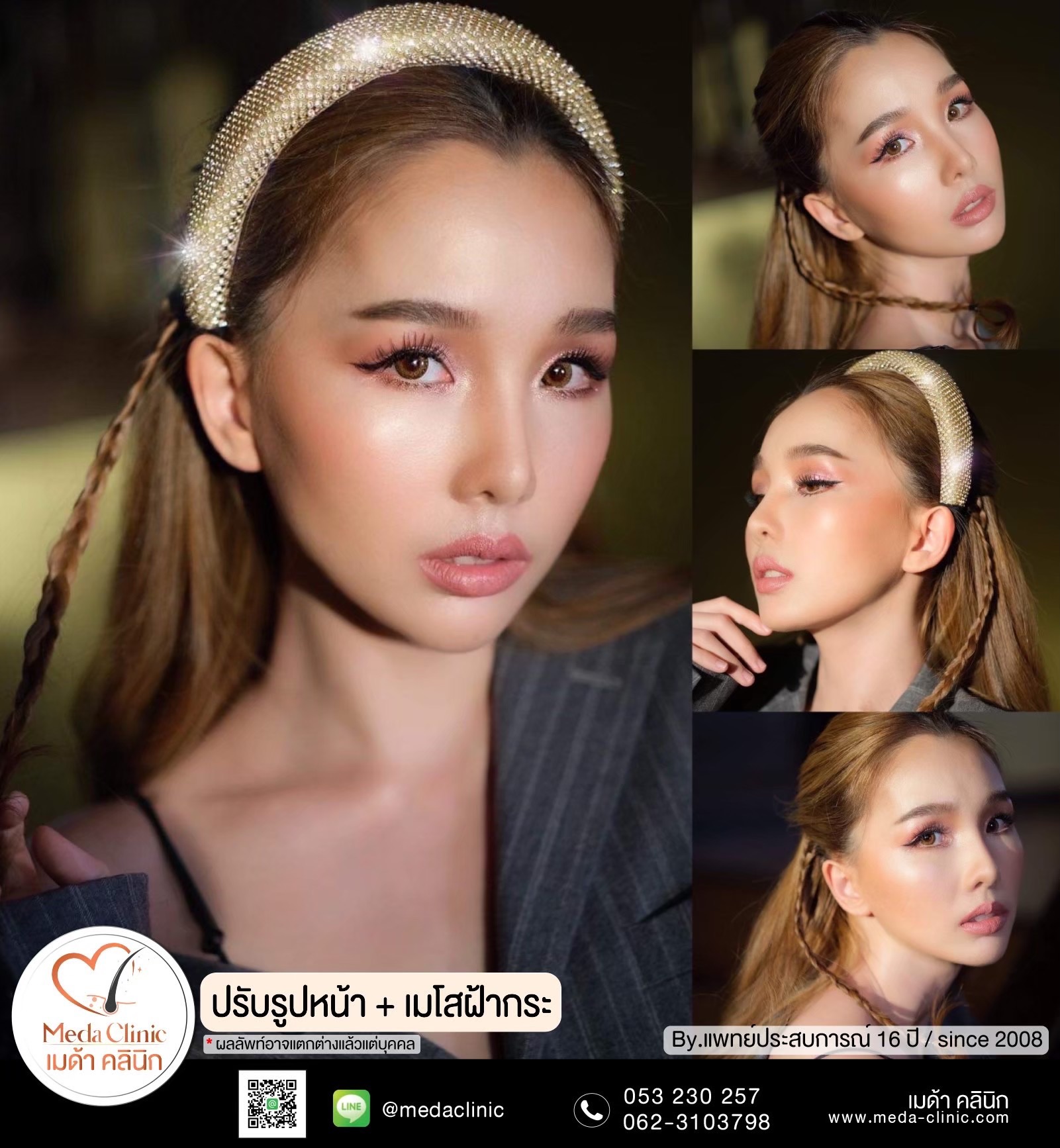 เลเซอร์ฝ้ากระที่ไหนดี