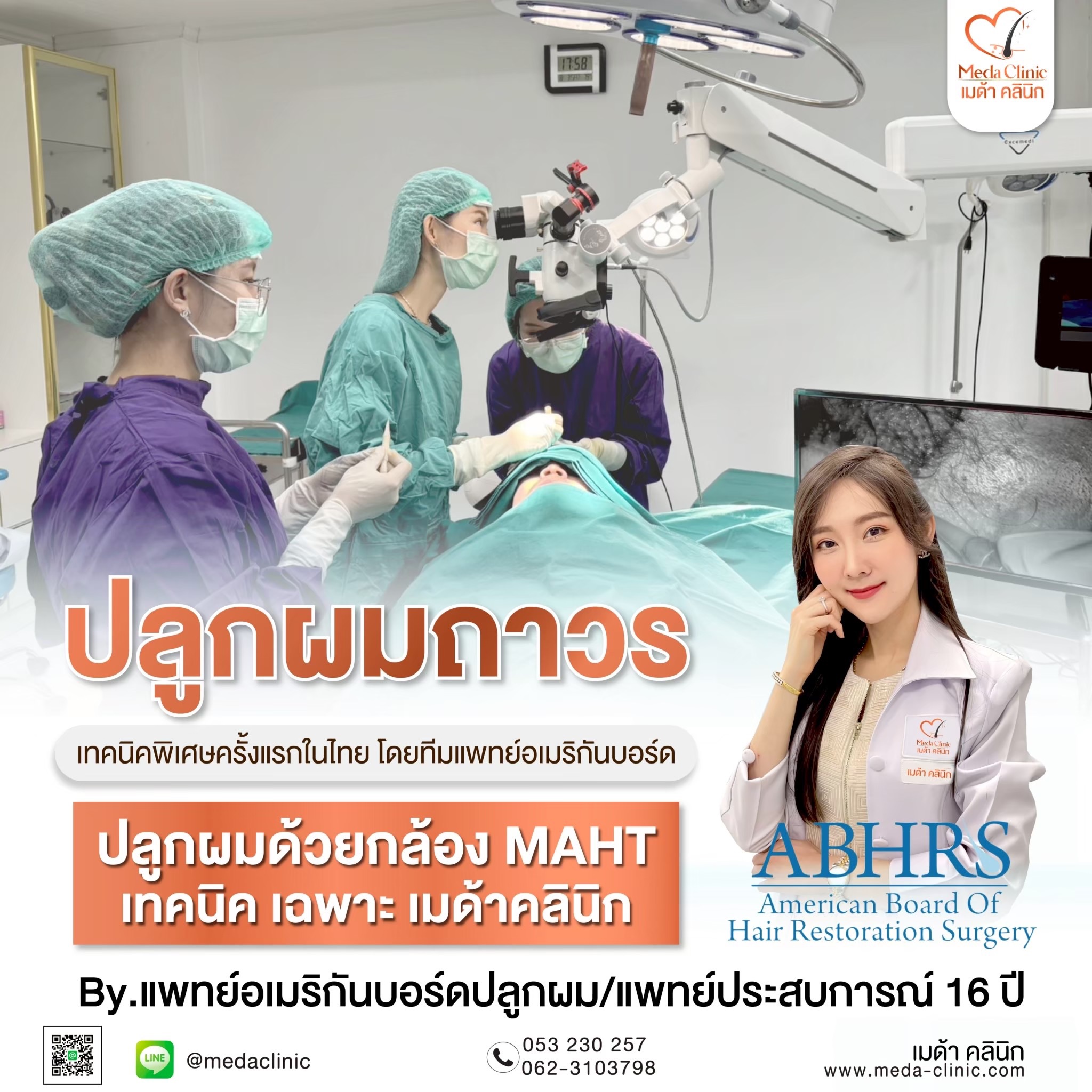 ปลูกผม FUE