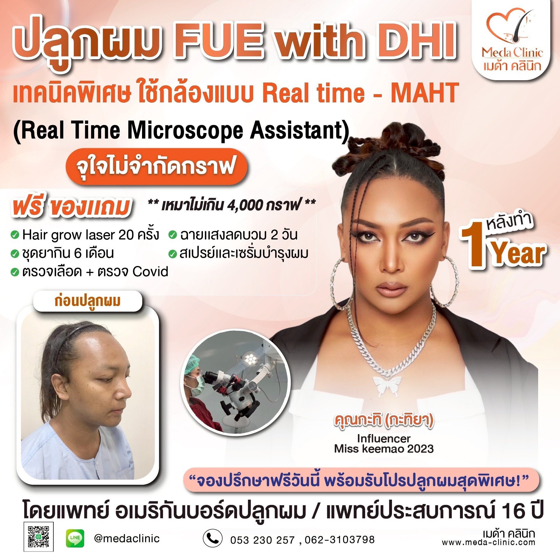 ปลูกไรผม