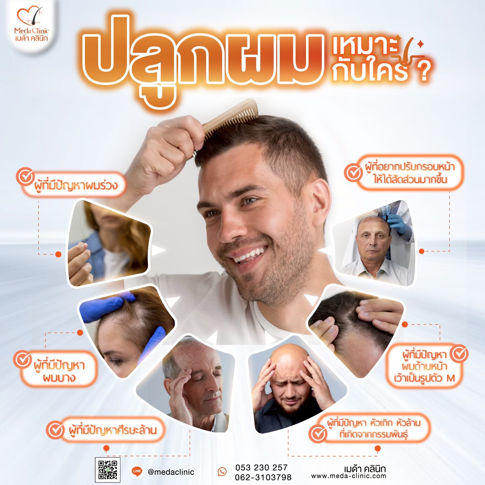 ปลูกไรผม