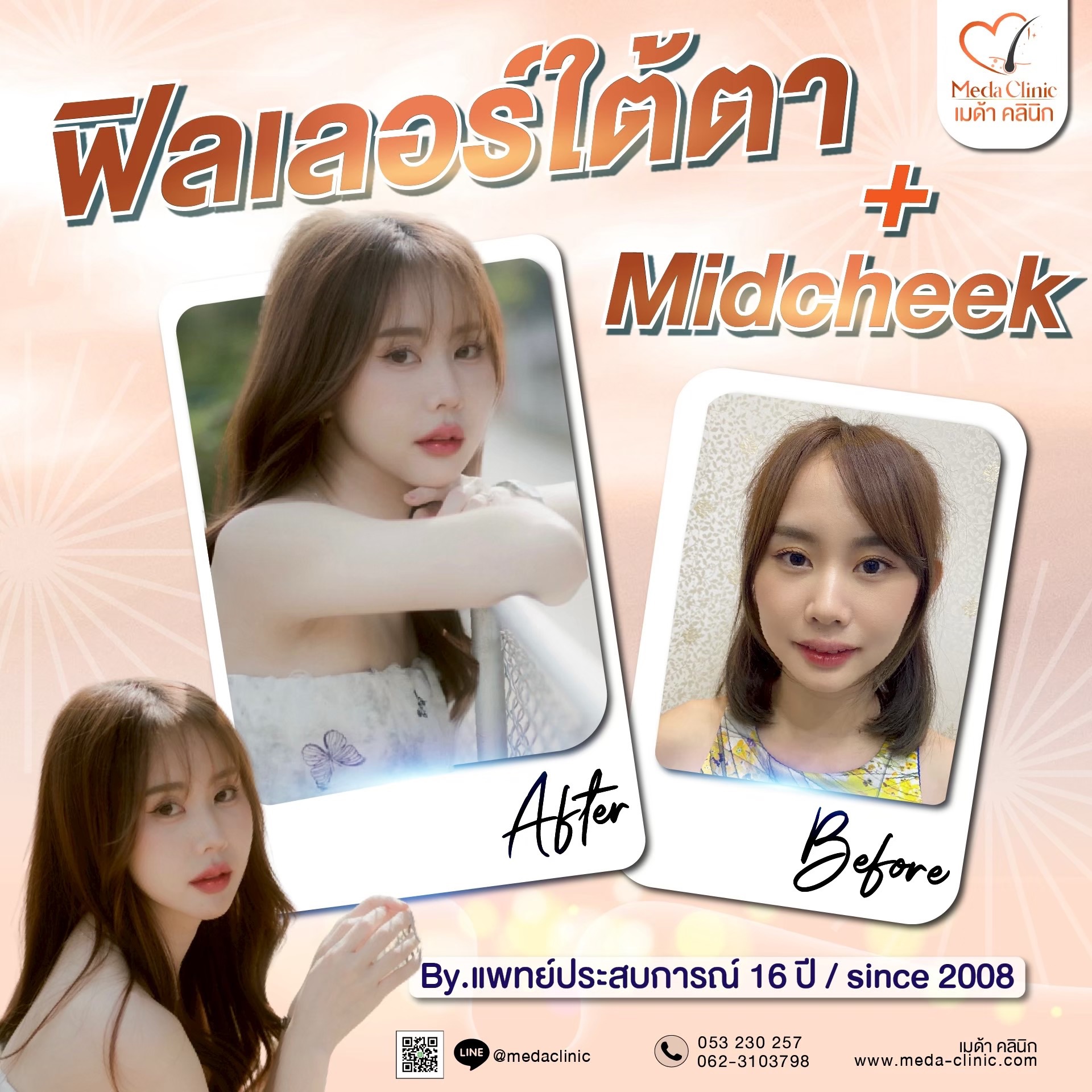 ร้อยไหม