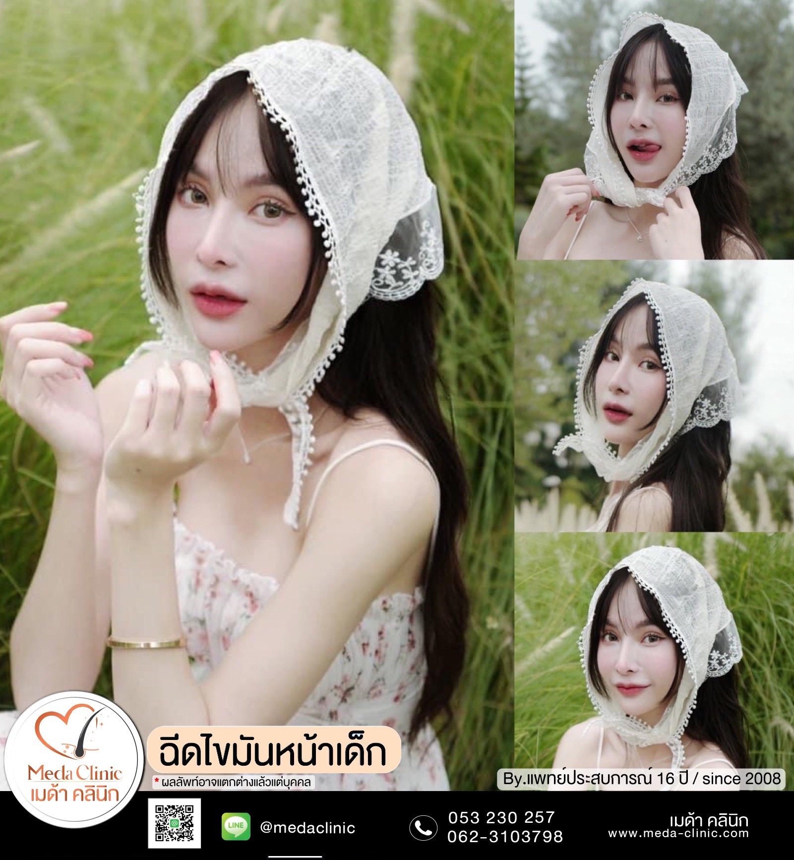 ฉีดไขมันหน้า