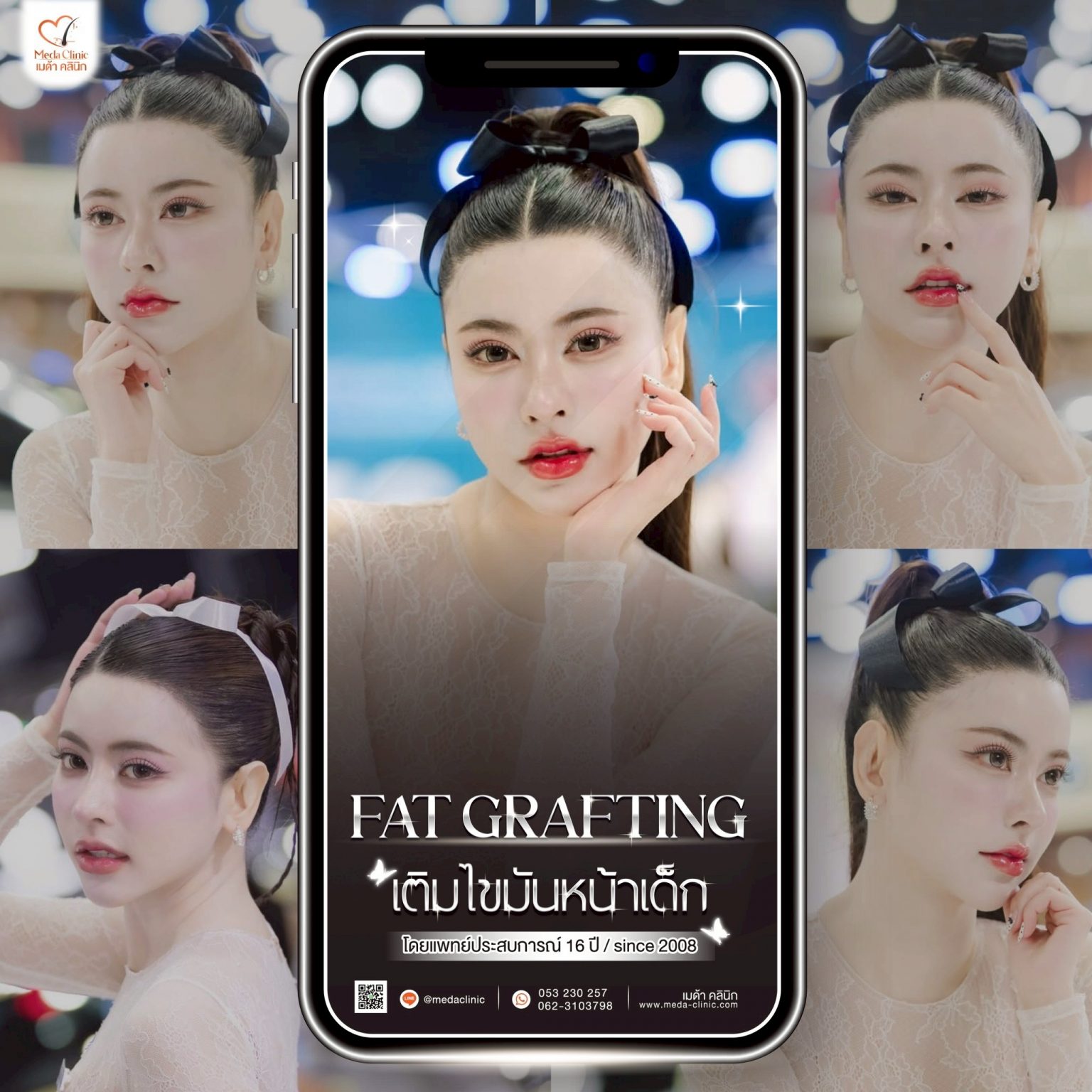 ฉีดไขมันที่ไหนดี