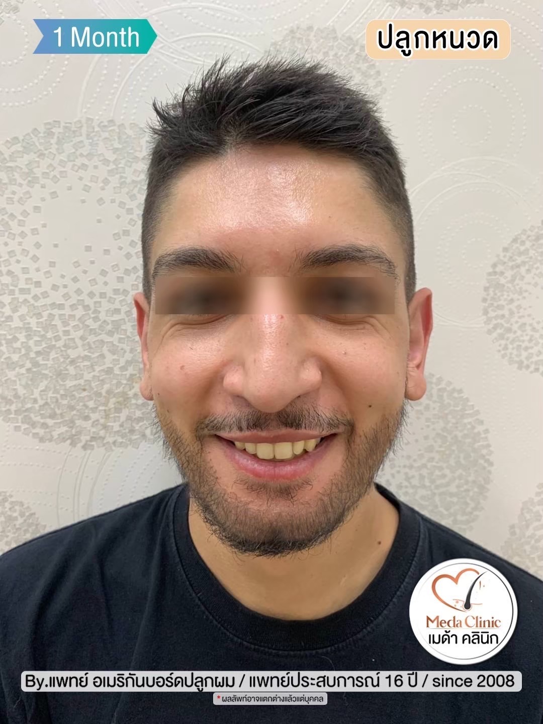 ปลููกหนวดเชียงใหม่