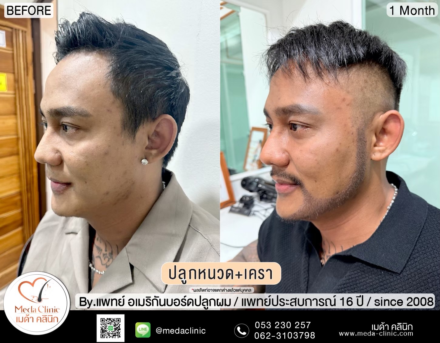 ปลููกหนวดเชียงใหม่
