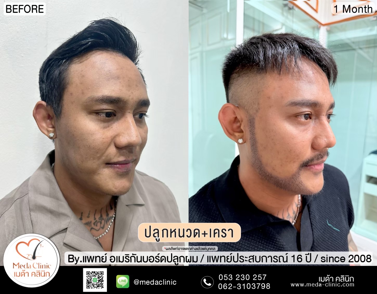 ปลููกหนวดเชียงใหม่