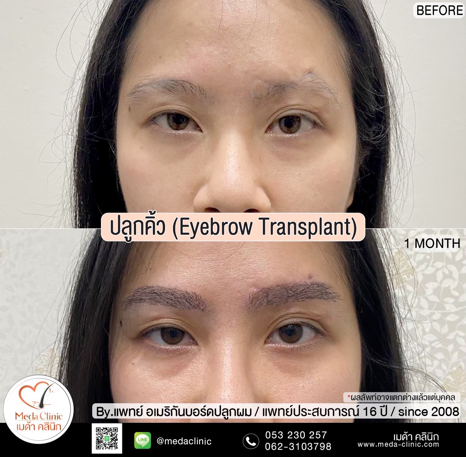 ปลููกหนวดเชียงใหม่