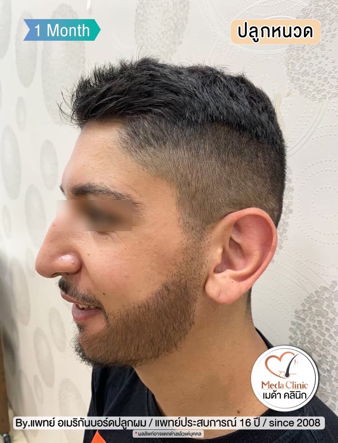 ปลููกหนวดเชียงใหม่