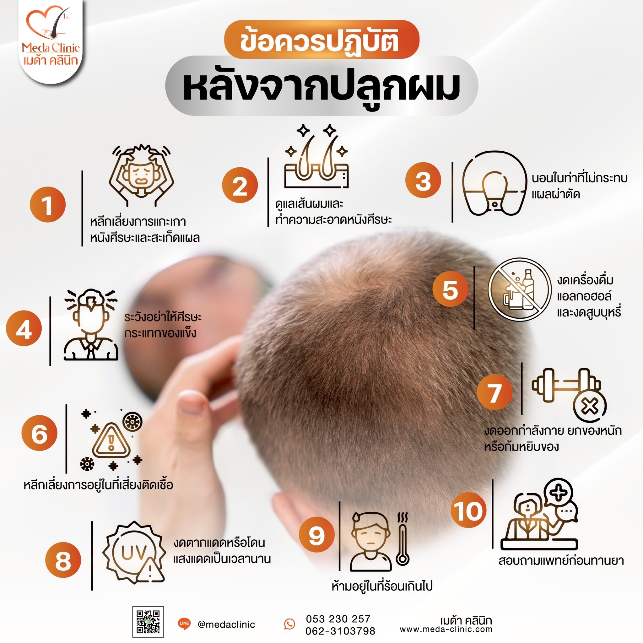 ปลูกหนวด