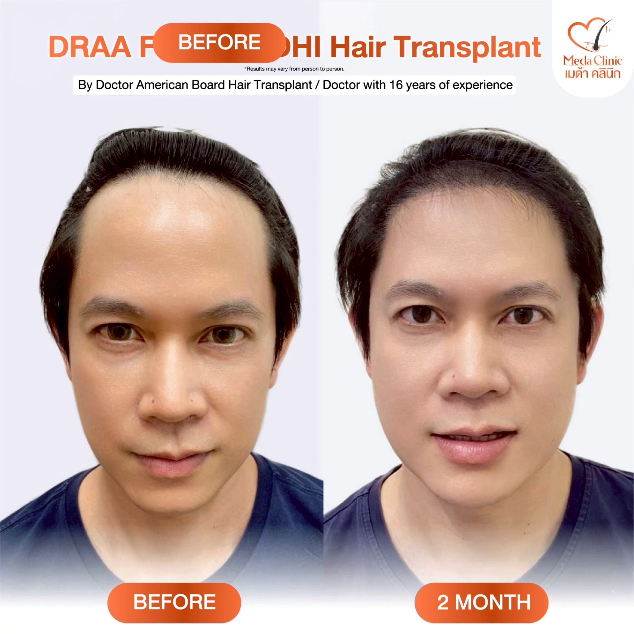 Hair transplant clinic