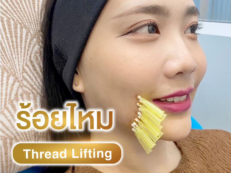 ร้อยไหม