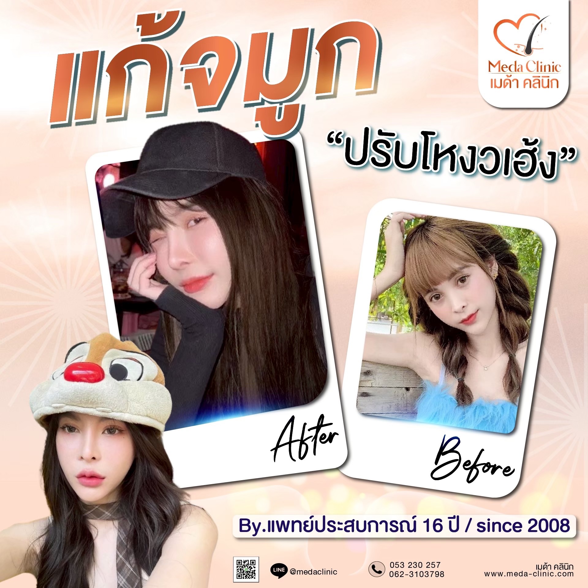 แก้จมูกที่ไหนดี