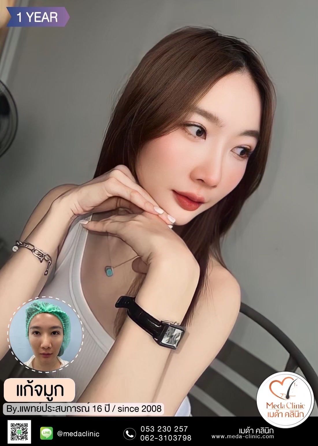 แก้จมูก