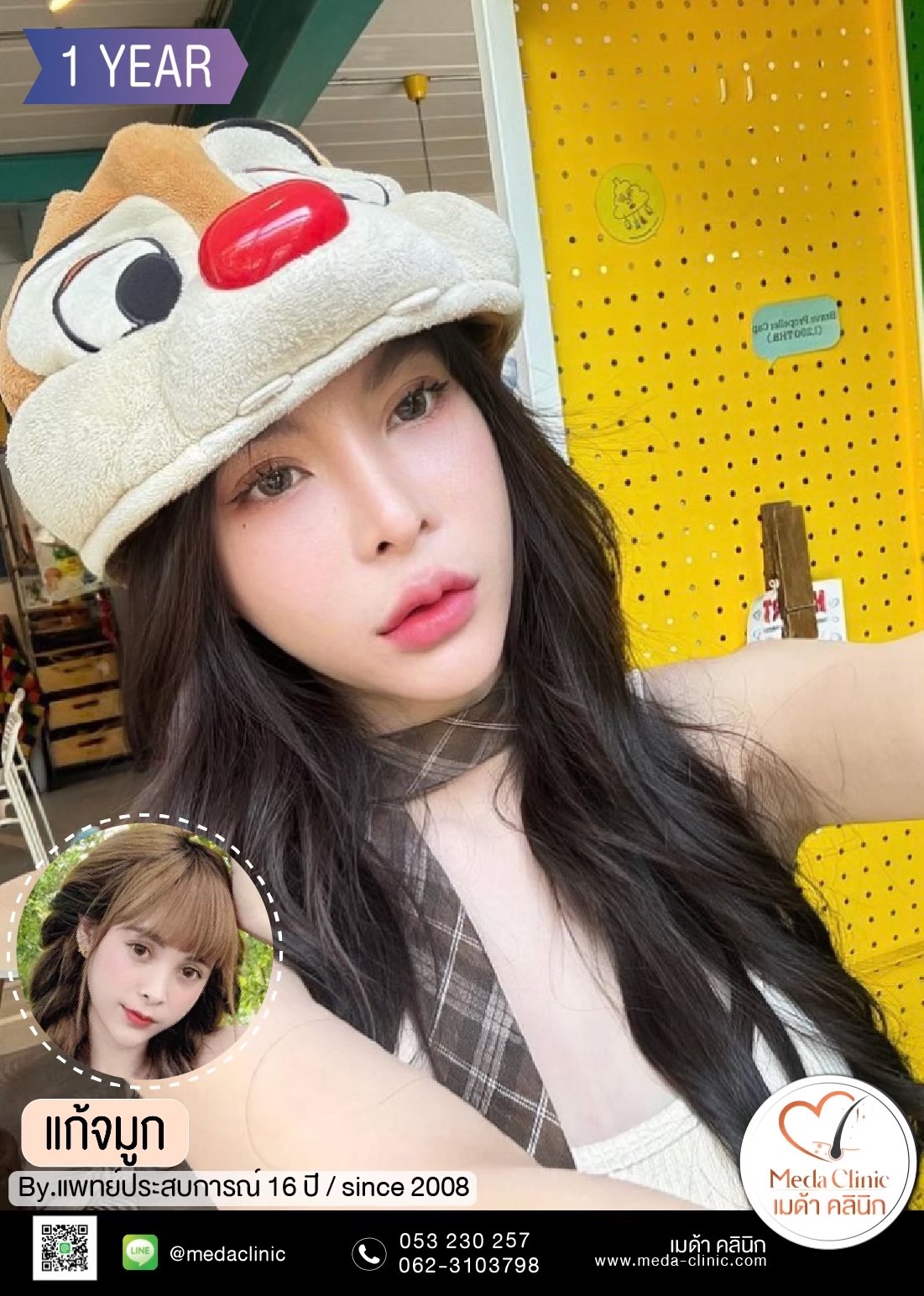 แก้จมูกที่ไหนดี?