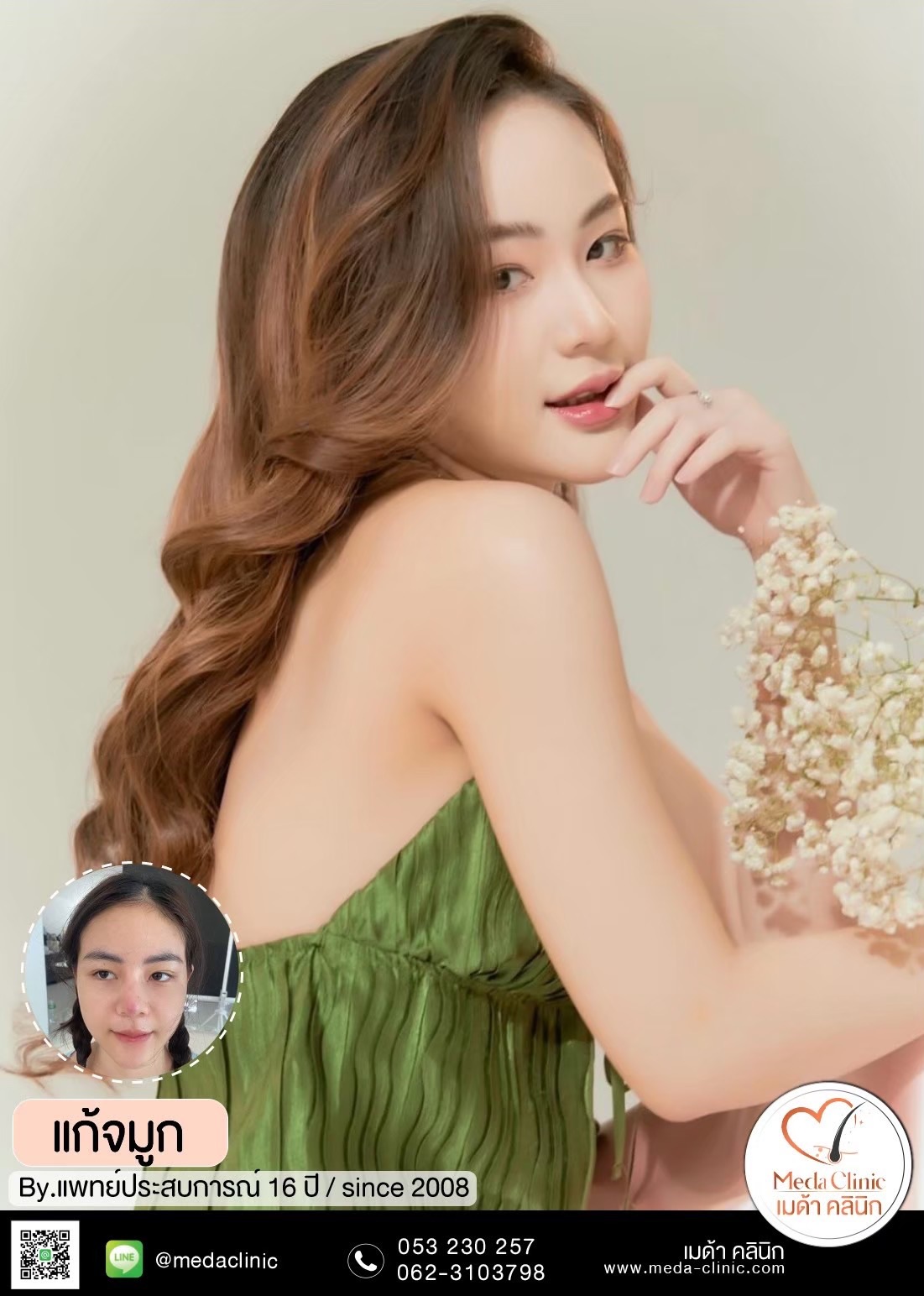 แก้จมูก