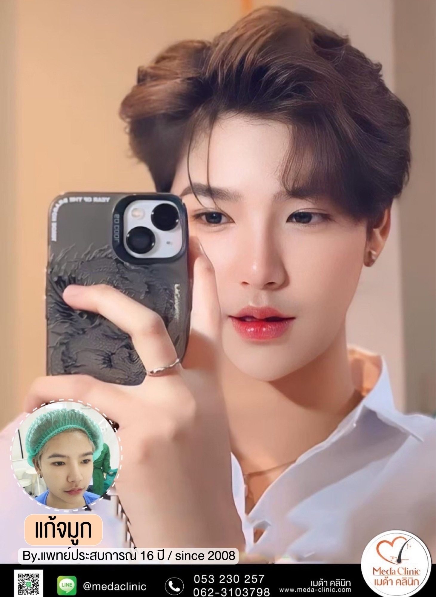 แก้จมูกที่ไหนดี?