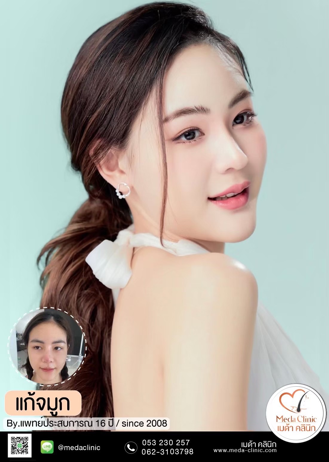 แก้จมูก