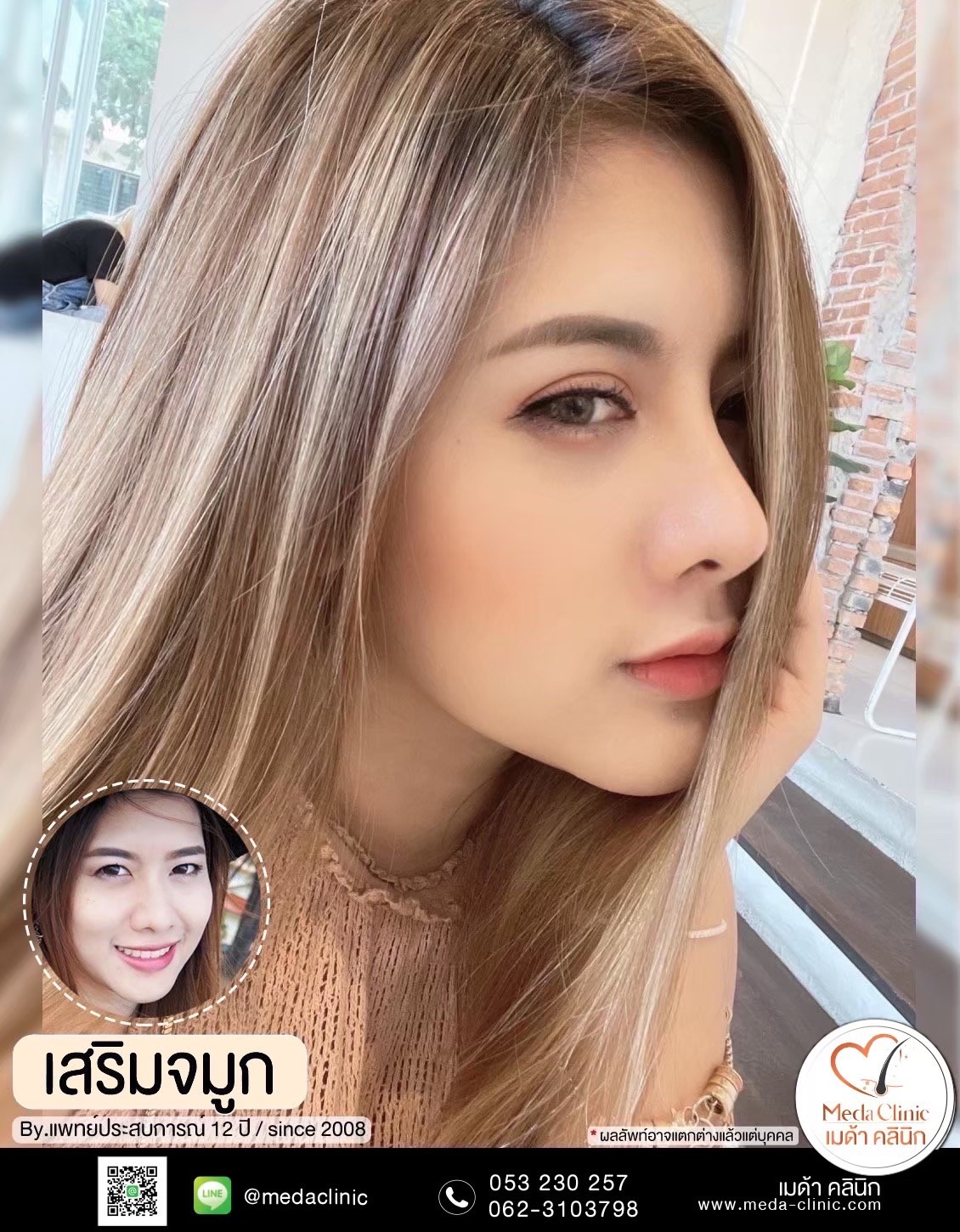 แก้จมูก