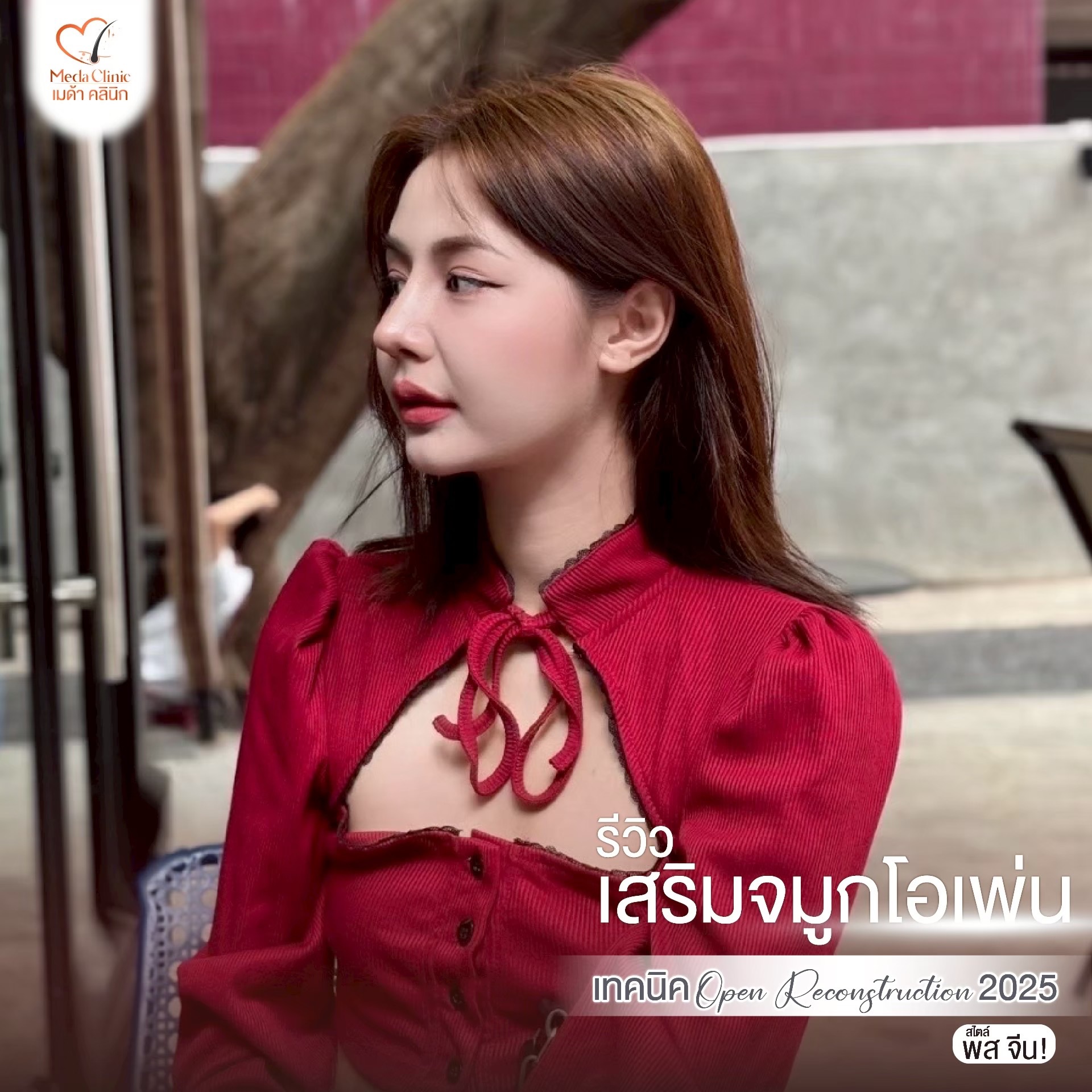 แก้จมูกที่ไหนดี ?