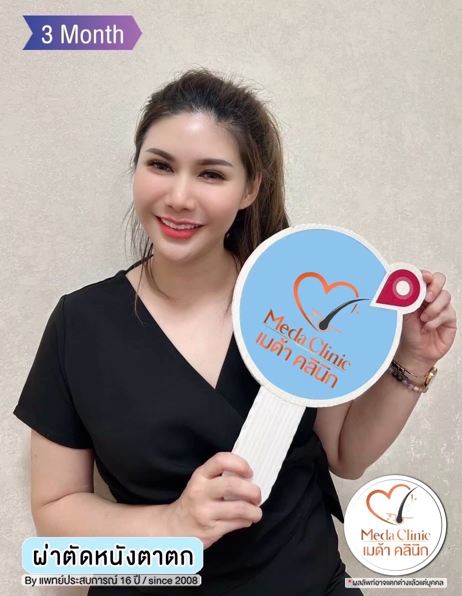 ผ่าตัดแก้หนังตาตก