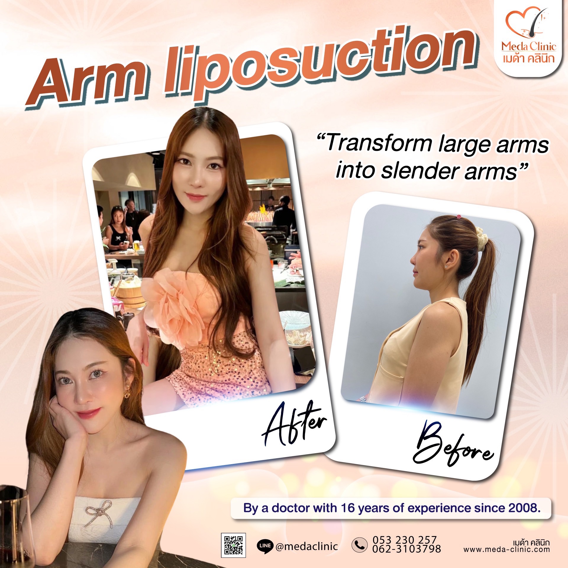 The best liposuction clinic