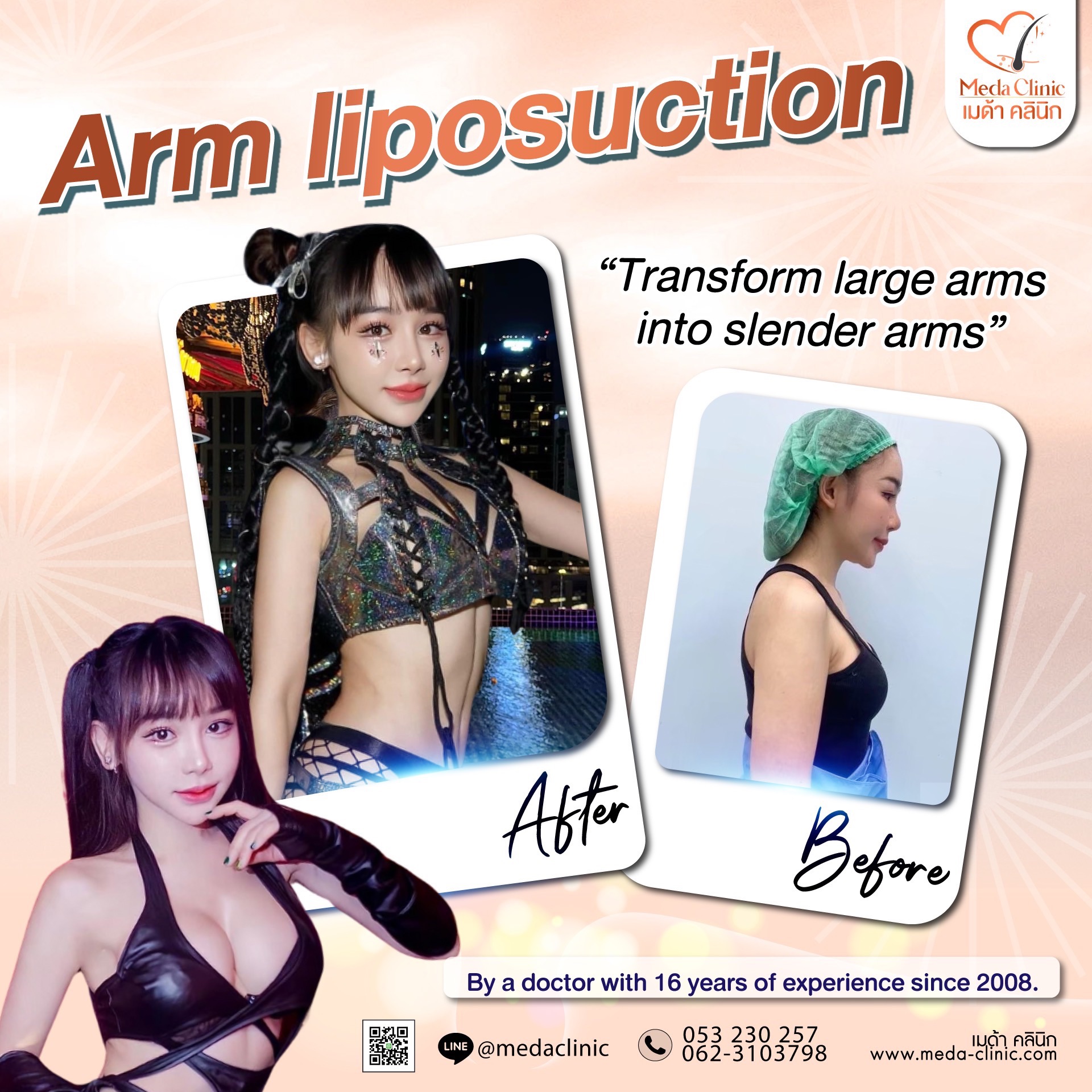 The best liposuction clinic