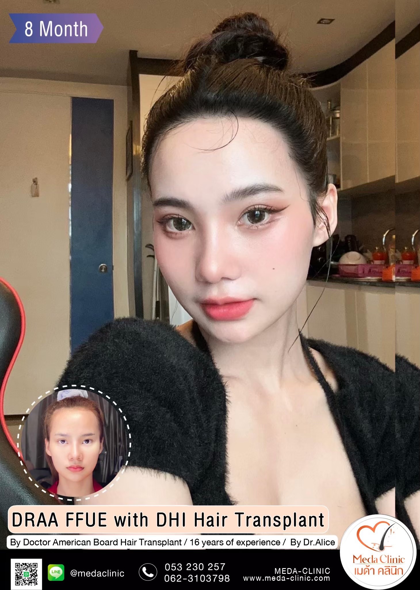 Hair Clinic ChiangMai 2026