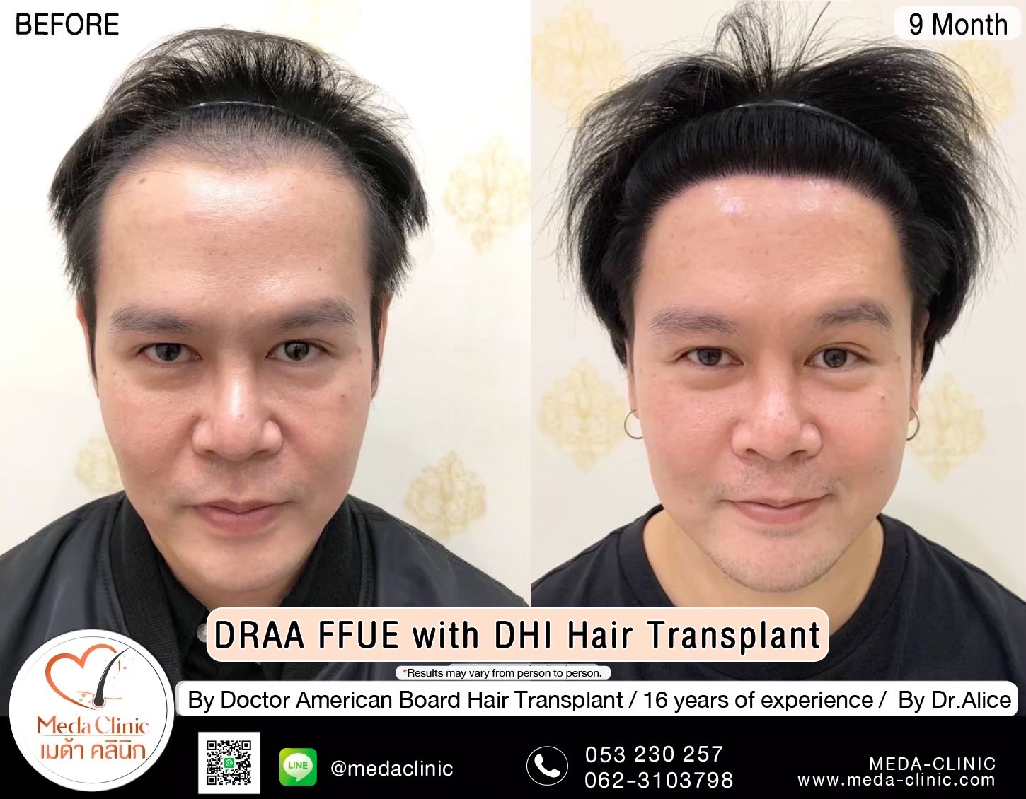 Hair Clinic ChiangMai