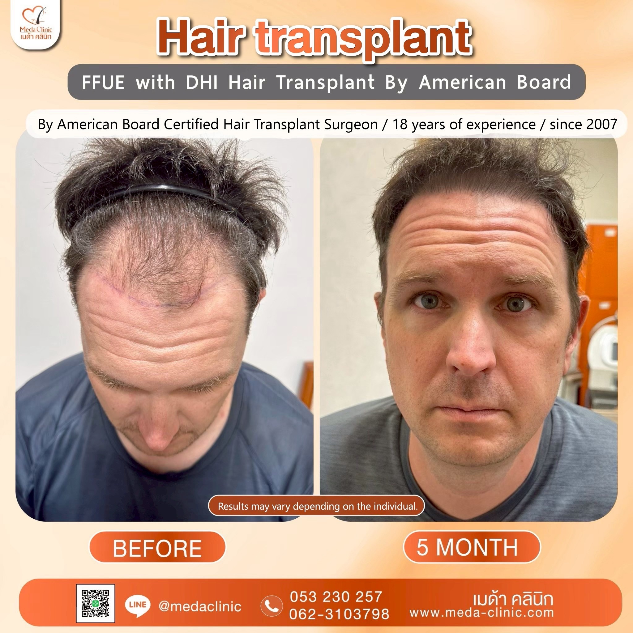 Hair Clinic ChiangMai