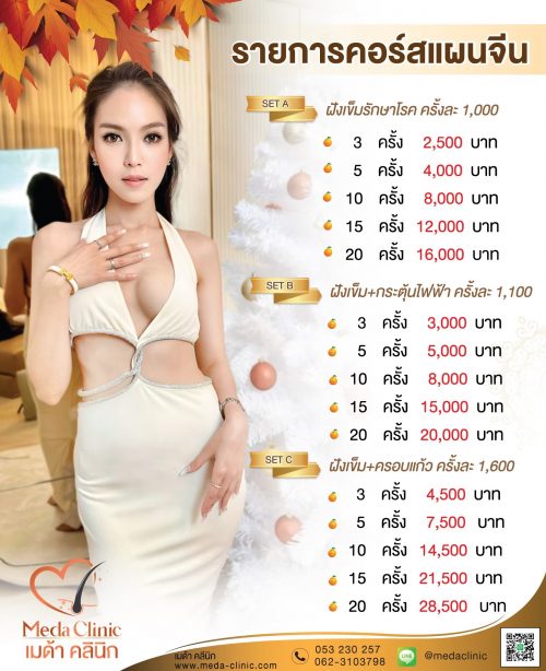 โปรฝังเข็ม โปรฝังเข็ม