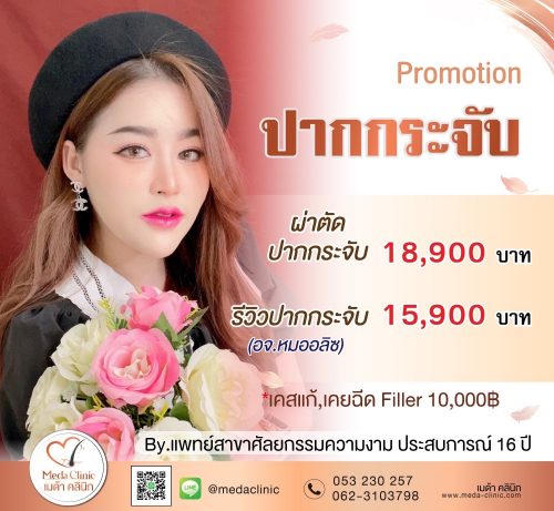 promotion ทำปากกระจับ